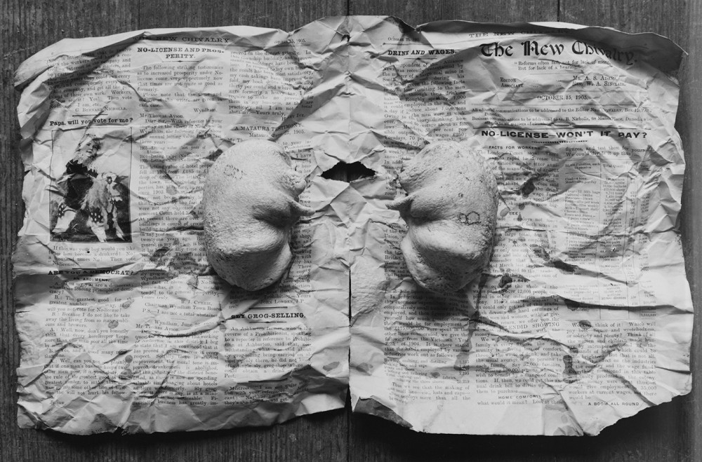 A lack of hearing (recto) | Vincent Chevillon
Bulles tympanique de rorqual et journal
2017