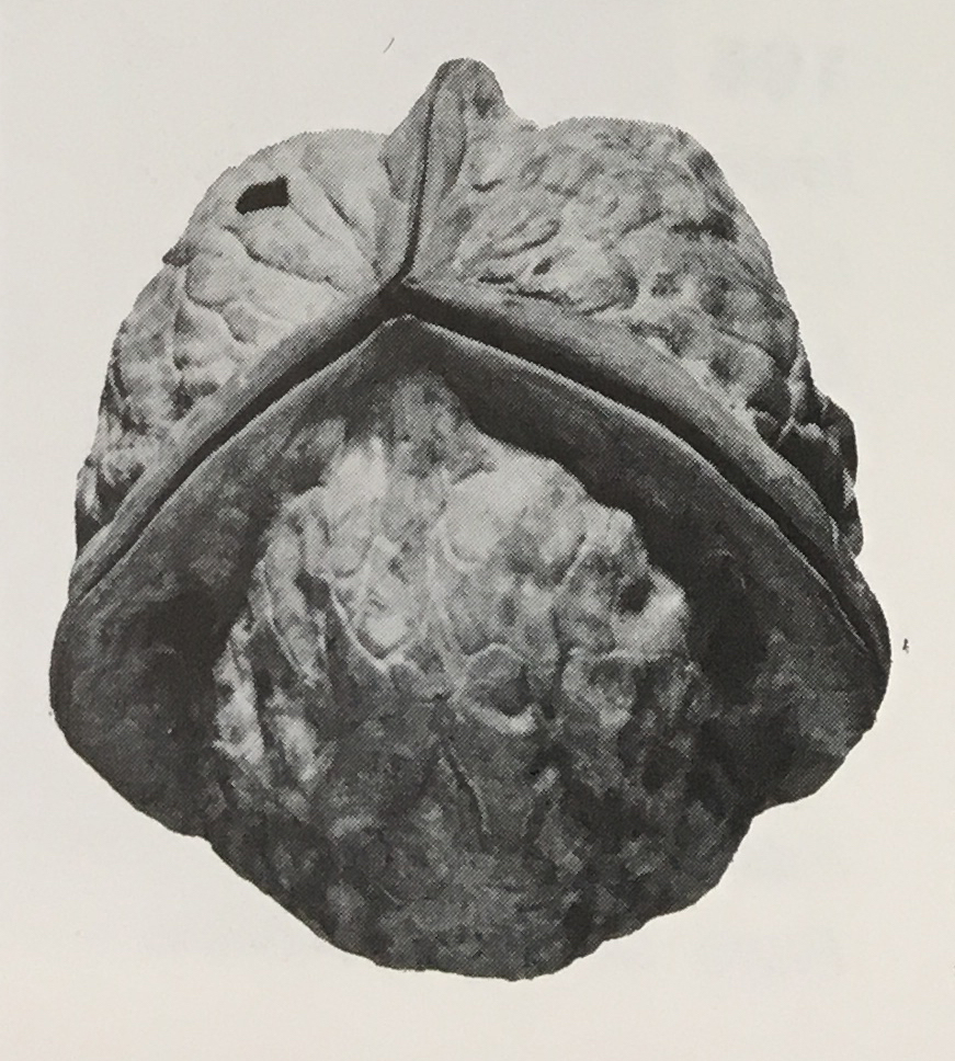 Noix trilobée | Noix trilobée,
Provence
Arles, Museon Arlaten.
Inv 2312